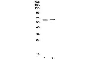 Western blot testing of 1) human placenta and 2) mouse testis lysate with RUNX1T1 antibody at 0. (RUNX1T1 anticorps)