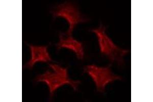 ABIN6274243 staining HepG2 by IF/ICC.