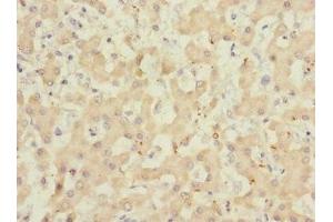 Immunohistochemistry of paraffin-embedded human liver tissue using ABIN7143271 at dilution of 1:100 (ADAMTSL4 anticorps  (AA 795-1074))