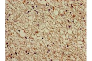 Immunohistochemistry of paraffin-embedded human brain tissue using ABIN7142928 at dilution of 1:100 (ABI2 anticorps  (AA 164-452))