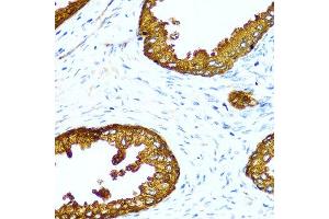 Immunohistochemistry of paraffin-embedded human prostate using ACPP antibody at dilution of 1:100 (40x lens). (ACPP anticorps)