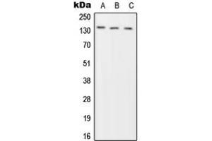 Western blot analysis of Phogrin expression in HeLa (A), SP2/0 (B), H9C2 (C) whole cell lysates. (PTPRN2 anticorps  (Center))