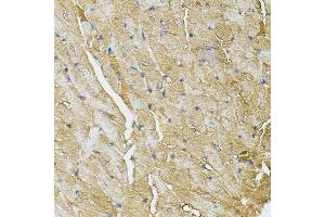 Immunohistochemistry of paraffin-embedded mouse heart using TRPC1 antibody (ABIN6003660) (40x lens). (TRPC1 anticorps)
