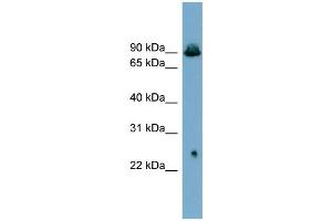WB Suggested Anti-SLC6A5  Antibody Titration: 0. (SLC6A5 anticorps  (Middle Region))