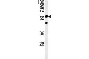 PHGDH antibody western blot analysis in Ramos lysate. (PHGDH anticorps  (AA 249-277))