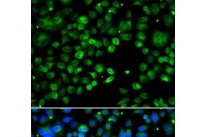 Immunofluorescence analysis of MCF-7 cells using TXNDC5 Polyclonal Antibody (TXNDC5 anticorps)