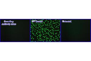 DNA Damage Induced by UV Light in Hela Cells. (Cellular UV-Induced DNA Damage Kit ELISA)