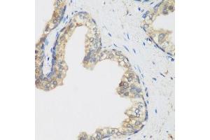 Immunohistochemistry of paraffin-embedded human prostate using NCBP2 antibody.