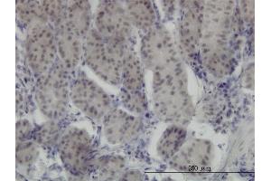 Immunoperoxidase of monoclonal antibody to RUNX1 on formalin-fixed paraffin-embedded human stomach.