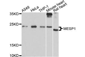 Western blot analysis of extracts of various cells, using MESP1 antibody. (MESP1 anticorps)