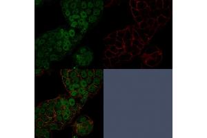 Confocal immunofluorescence image of MCF-7 cells using CHD4 Mouse Monoclonal Antibody (3F2/4) stained in Green (CF488) and Phalloidin is used to label the membranes. (CHD4 anticorps  (C-Term))