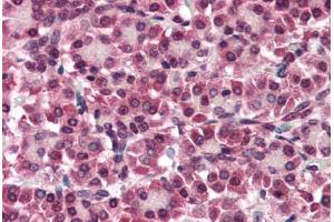 Human Pancreas (formalin-fixed, paraffin-embedded) stained with GPC4 antibody ABIN351425 at 5-10 ug/ml followed by biotinylated goat anti-rabbit IgG secondary antibody ABIN481713, alkaline phosphatase-streptavidin and chromogen. (GPC4 anticorps  (Internal Region))