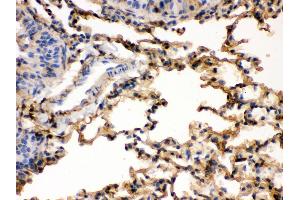 Immunohistochemistry (Paraffin-embedded Sections) (IHC (p)) image for anti-S100 Calcium Binding Protein A6 (S100A6) (AA 1-90) antibody (ABIN3043320)
