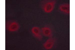 ABIN6267458 staining Hela cells by ICC/IF.