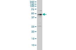 PHF1 monoclonal antibody (M01), clone 2D3 Western Blot analysis of PHF1 expression in A-431 . (PHF1 anticorps  (AA 2-100))
