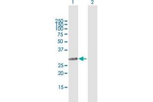 Western Blot analysis of SMNDC1 expression in transfected 293T cell line by SMNDC1 MaxPab polyclonal antibody. (SMNDC1 anticorps  (AA 1-238))