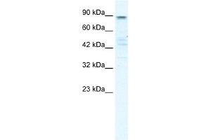 WB Suggested Anti-KCNQ2 Antibody Titration:  0. (KCNQ2 anticorps  (N-Term))