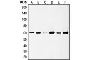 Western blot analysis of c-SRC (pS75) expression in HeLa (A), HuvEc (B), Jurkat (C), COLO205 (D), HEK293T EGF-treated (E), A431 pervanadate-treated (F) whole cell lysates. (Src anticorps  (N-Term, pSer75))