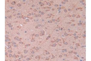 IHC-P analysis of Mouse Cerebrum Tissue, with DAB staining. (CD38 anticorps  (AA 54-301))