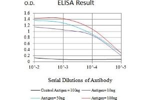 Black line: Control Antigen (100 ng),Purple line: Antigen (10 ng), Blue line: Antigen (50 ng), Red line:Antigen (100 ng) (ACTH anticorps)