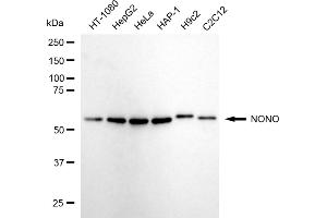 Western blotting analysis using NONO antibody (ABIN7799618).