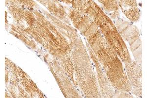 ABIN6274975 at 1/100 staining human skeletal muscle tissue sections by IHC-P. (CPT1B anticorps  (Internal Region))