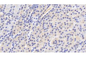 Detection of CYPA in Human Kidney Tissue using Polyclonal Antibody to Cyclophilin A (CYPA)