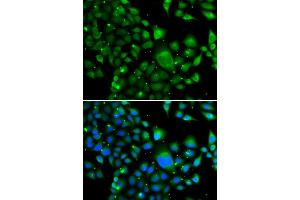 Immunofluorescence analysis of MCF-7 cells using WBSCR22 antibody (ABIN4905616). (WBSCR22 anticorps)