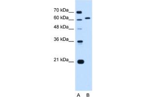 Western Blotting (WB) image for anti-Lamin B2 (LMNB2) antibody (ABIN2462974) (Lamin B2 anticorps)