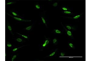 Immunofluorescence of purified MaxPab antibody to MLLT1 on HeLa cell. (MLLT1 anticorps  (AA 1-559))
