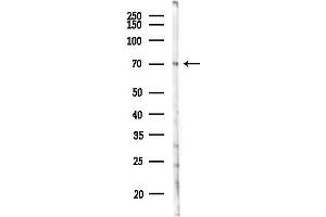 Western blot analysis of lysates from Rat liver, using TMCO3 Antibody at 1/1000 dilution.