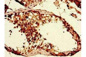 Immunohistochemistry of paraffin-embedded human testis tissue using ABIN7152373 at dilution of 1:100 (CAPZA1 anticorps  (AA 211-252))