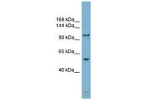 Image no. 1 for anti-ArfGAP with SH3 Domain, Ankyrin Repeat and PH Domain 3 (ASAP3) (AA 35-84) antibody (ABIN6744107)