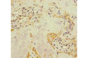 Immunohistochemistry of paraffin-embedded human placenta tissue using ABIN7157836 at dilution of 1:100 (A4GALT anticorps  (AA 244-353))
