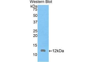 Western Blotting (WB) image for anti-Actin Related Protein 2/3 Complex, Subunit 4, 20kDa (ARPC4) (AA 79-164) antibody (ABIN1858082) (ARPC4 anticorps  (AA 79-164))