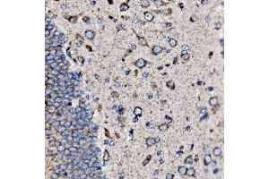 anti-Serotonin Receptor 1B (HTR1B) (AA 35-390) antibody