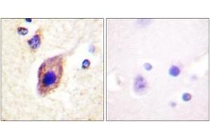 Immunohistochemistry analysis of paraffin-embedded human brain tissue, using PLCG2 (Ab-1217) Antibody. (Phospholipase C gamma 2 anticorps  (AA 1186-1235))
