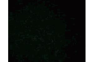 Immunofluorescence staining of phosphoserine/threonine (clone 22A, MN ABIN968873) on A431 cells (Human epithelial carcinoma, ATCC CRL-1555). (Phosphoserine/Threonine anticorps)