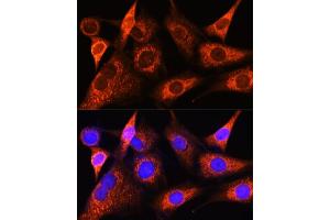 Immunofluorescence analysis of NIH-3T3 cells using PS Rabbit pAb (ABIN6132524, ABIN6146286, ABIN6146288 and ABIN6222421) at dilution of 1:100 (40x lens). (PSAT1 anticorps  (AA 1-370))