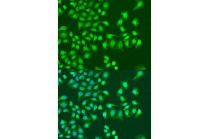 Immunofluorescence analysis of U2OS cells using NIN antibody (ABIN6291434) at dilution of 1:100. (Ninein anticorps)