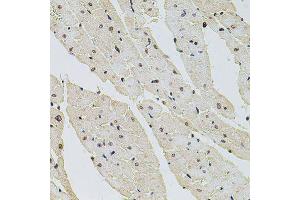 Immunohistochemistry of paraffin-embedded rat heart using HIST1H2AG antibody (ABIN6003627) at dilution of 1/100 (40x lens).