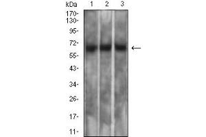 Western blot analysis using MSLN mouse mAb against PC-3 (1), SK-MES-1 (2), and CHO3D10 (3) cell lysate. (Mesothelin anticorps  (AA 296-606))