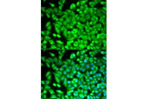 Immunofluorescence analysis of MCF-7 cells using FBP1 antibody (ABIN5973135). (FBP1 anticorps)