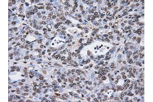 Image no. 13 for anti-ATP Synthase, H+ Transporting, Mitochondrial F1 Complex, beta Polypeptide (ATP5B) antibody (ABIN1496766)