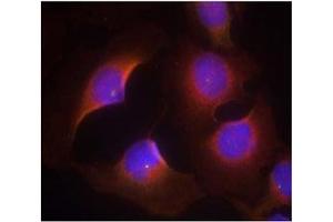 Image no. 3 for anti-Cyclin-Dependent Kinase 6 (CDK6) (pTyr13) antibody (ABIN401597)