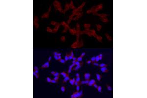 Immunofluorescence analysis of SH-SY5Y cells using TRPC5 Rabbit pAb (ABIN6128835, ABIN6149578, ABIN6149579 and ABIN6214219) at dilution of 1:150 (40x lens).