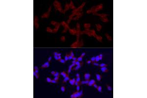 Immunofluorescence analysis of SH-SY5Y cells using TRPC5 Rabbit pAb (ABIN6128835, ABIN6149578, ABIN6149579 and ABIN6214219) at dilution of 1:150 (40x lens).
