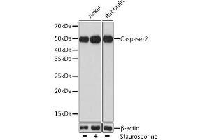 Western blot analysis of extracts of various cell lines using Caspase-2 Polyclonal Antibody at dilution of 1:1000. (Caspase 2 anticorps)