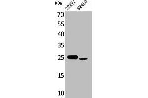 Western Blot analysis of 22RV-1 SW480 cells using SSX Polyclonal Antibody (SSX1 anticorps  (C-Term))