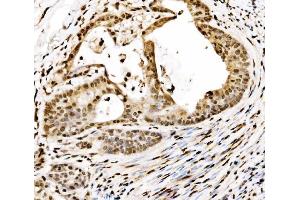 IHC analysis of SPHK1 using anti-SPHK1 antibody (ABIN7600168).